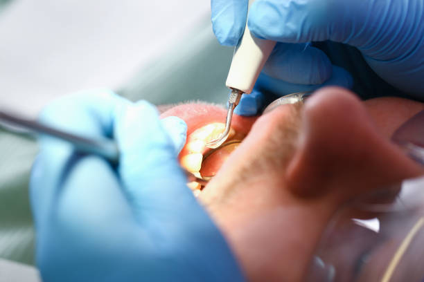 Best Walk-In Emergency Dental Services in South Bradenton, FL
